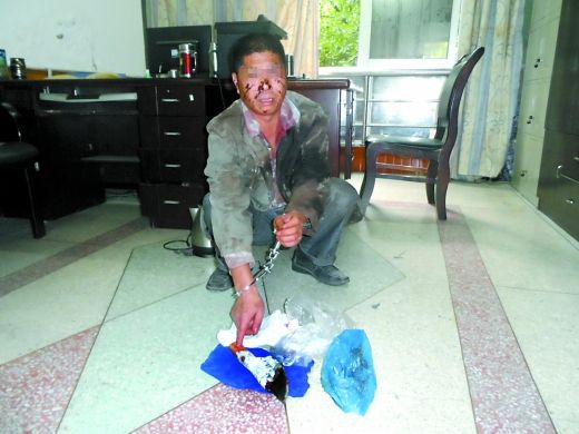   目前張遠(yuǎn)已被刑事拘留。