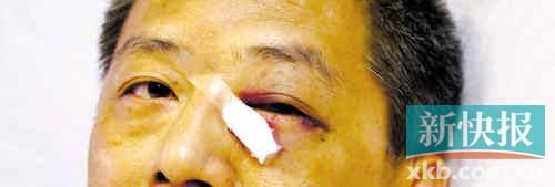 ■這起醫(yī)鬧事件，受傷的遠(yuǎn)遠(yuǎn)不只是熊旭明醫(yī)生的身體。