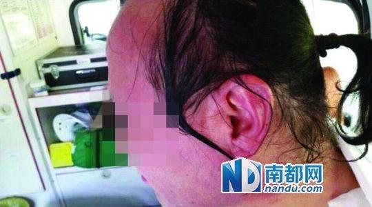 涉事教師遭熱水潑臉后的照片。