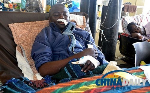 雖然已經(jīng)在醫(yī)院接受了近一個(gè)月的恢復(fù)治療，卡托卡的身體仍然非常虛弱。