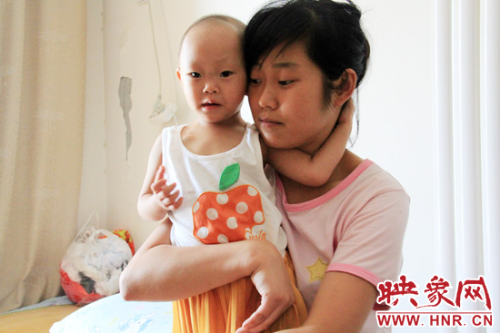 孩子和媽媽在一起，她的右眼已經(jīng)失明。