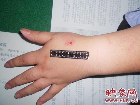 為幫助無(wú)證駕駛的朋友逃避處罰，新鄉(xiāng)的王某竟對(duì)執(zhí)勤民警大打出手，還將一名民警的手臂咬傷