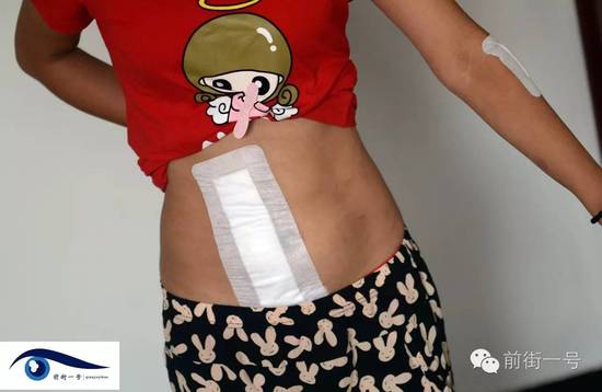 小金腹部的傷口。