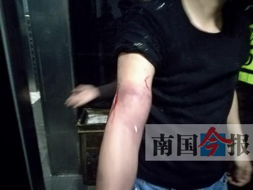 覃先生手臂被卡的部位受傷流血，所幸傷勢無大礙。 通訊員 王建民 攝