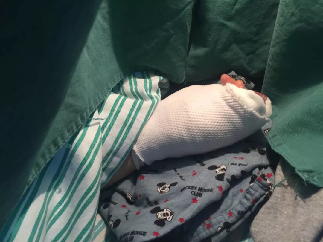 嚇哭！6歲男孩被夾斷手指 罪魁禍?zhǔn)拙故切７? oldsrc=