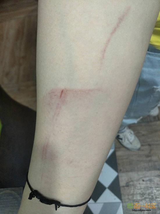 女網(wǎng)友舉報網(wǎng)帖中出示的被打后照片。