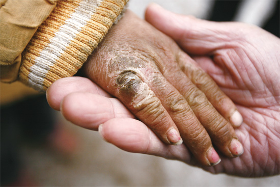 胡天格凍裂的小手撥動(dòng)了許多讀者的心弦 胡天格凍裂的小手撥動(dòng)了許多讀者的心弦