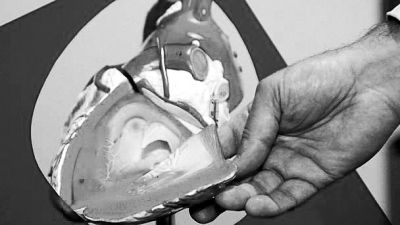 威廉斯領(lǐng)導(dǎo)的研究團隊已經(jīng)利用人體脂肪干細(xì)胞，成功3D打印出心臟血管和心臟瓣膜，待一顆心臟的所有部件打