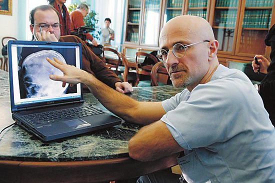 圖為卡納維洛醫(yī)生，不少人認(rèn)為他的想法非常瘋狂