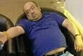 網(wǎng)傳金正男中毒后的照片。