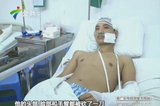 另一名傷者頭部、臉部和手臂都被砍了一刀。(視頻截圖)