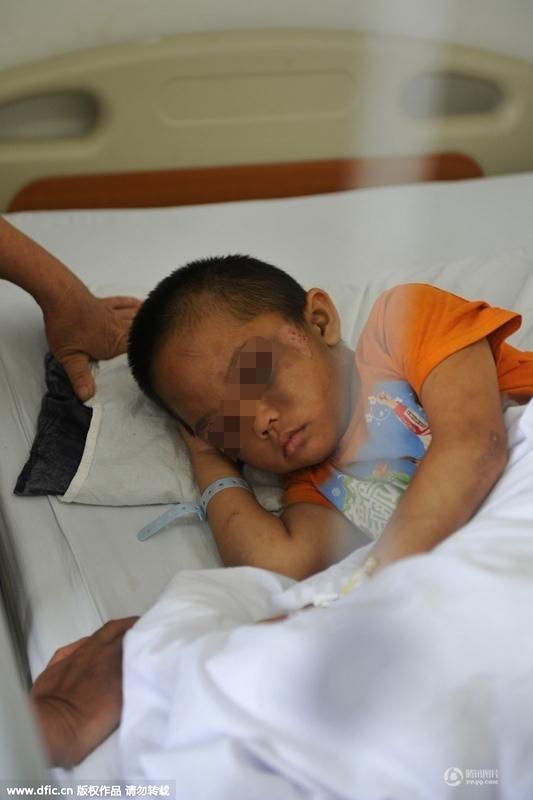 圖為全身傷痕累累的小進。