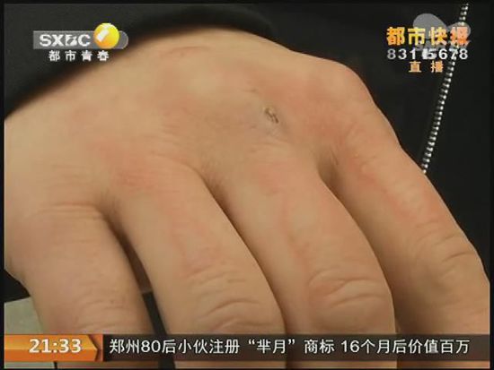 說到這足療拔罐，估計大伙都不陌生，但是想起4號晚上的拔罐的經(jīng)歷，呂先生現(xiàn)在想起來，還心有余悸。