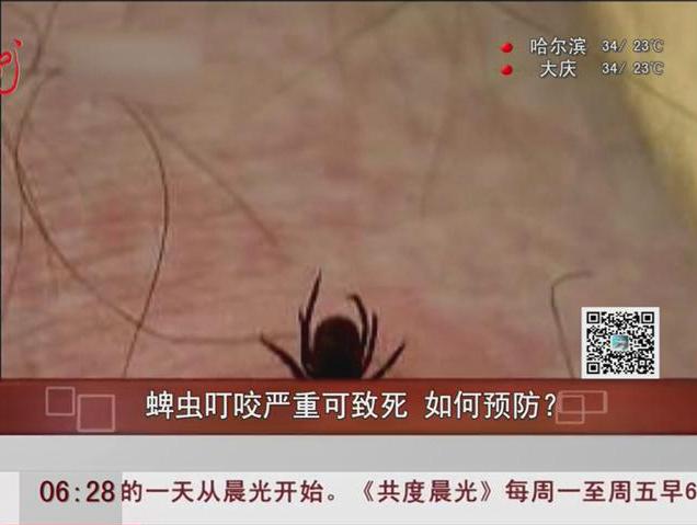 蜱蟲叮咬嚴(yán)重可致死如何預(yù)防？
