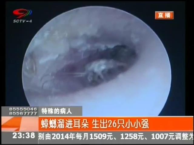 小強溜進耳朵？生26只小小強