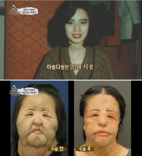 美女整容變“電風(fēng)扇大媽” 盤(pán)點(diǎn)整容失敗驚悚案例